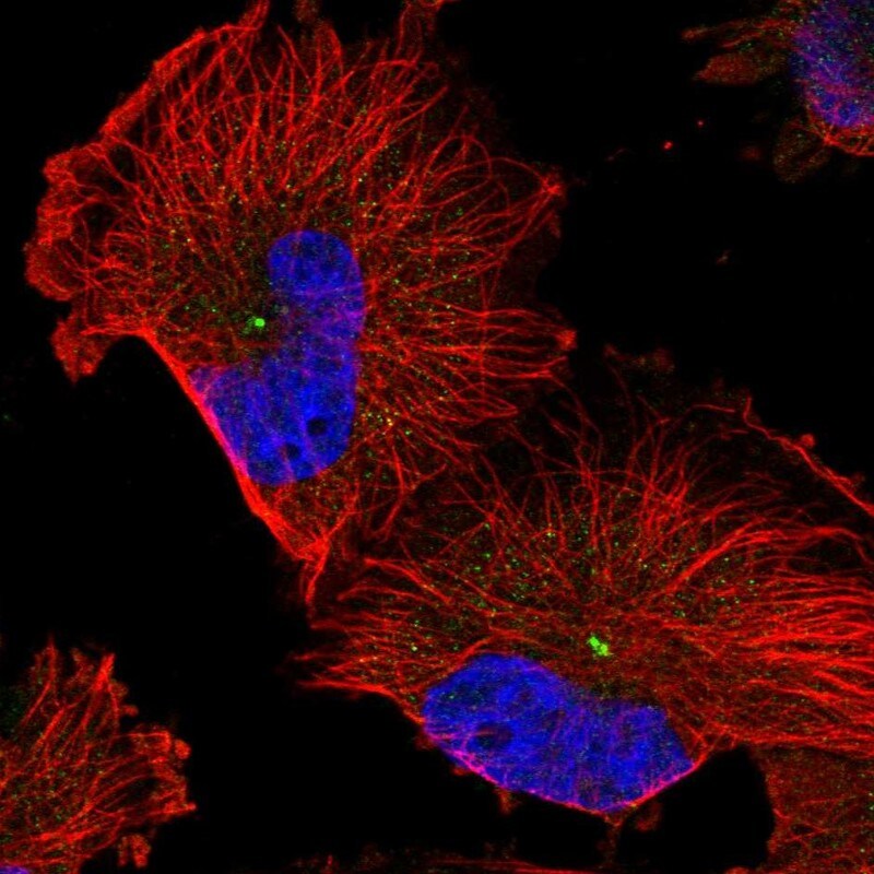 RMD1 Antibody - BSA Free Immunocytochemistry/ Immunofluorescence: RMD1 Antibody - BSA Free [NBP1-88089]