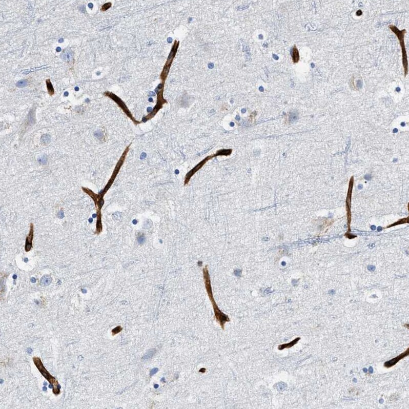 FAM18B Antibody - BSA Free Immunohistochemistry-Paraffin: FAM18B Antibody - BSA Free [NBP1-88090]