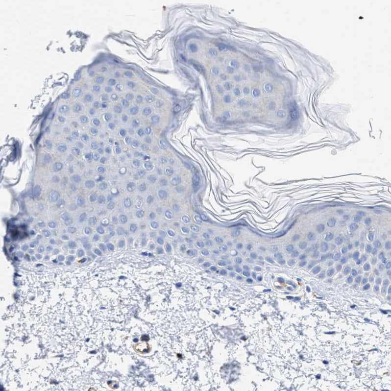 FAM18B Antibody - BSA Free Immunohistochemistry-Paraffin: FAM18B Antibody - BSA Free [NBP1-88090]