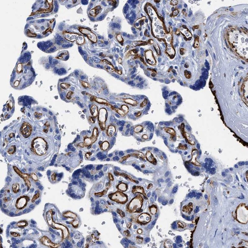 FAM18B Antibody - BSA Free Immunohistochemistry-Paraffin: FAM18B Antibody - BSA Free [NBP1-88090]