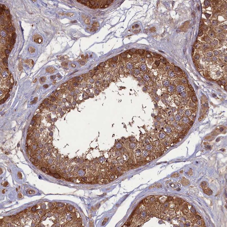 CGI-128 Antibody - BSA Free Immunohistochemistry-Paraffin: CGI-128 Antibody - BSA Free [NBP1-88091]