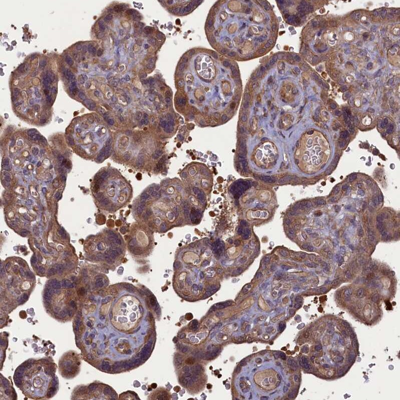 CGI-128 Antibody - BSA Free Immunohistochemistry-Paraffin: CGI-128 Antibody - BSA Free [NBP1-88091]