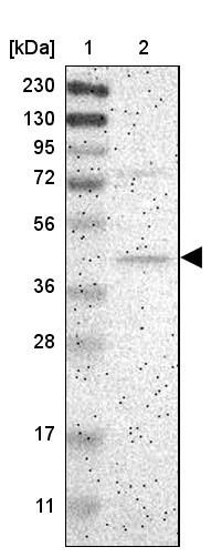 Centaurin alpha 1 Antibody - BSA Free Western Blot: Centaurin alpha 1 Antibody - BSA Free [NBP1-88097]