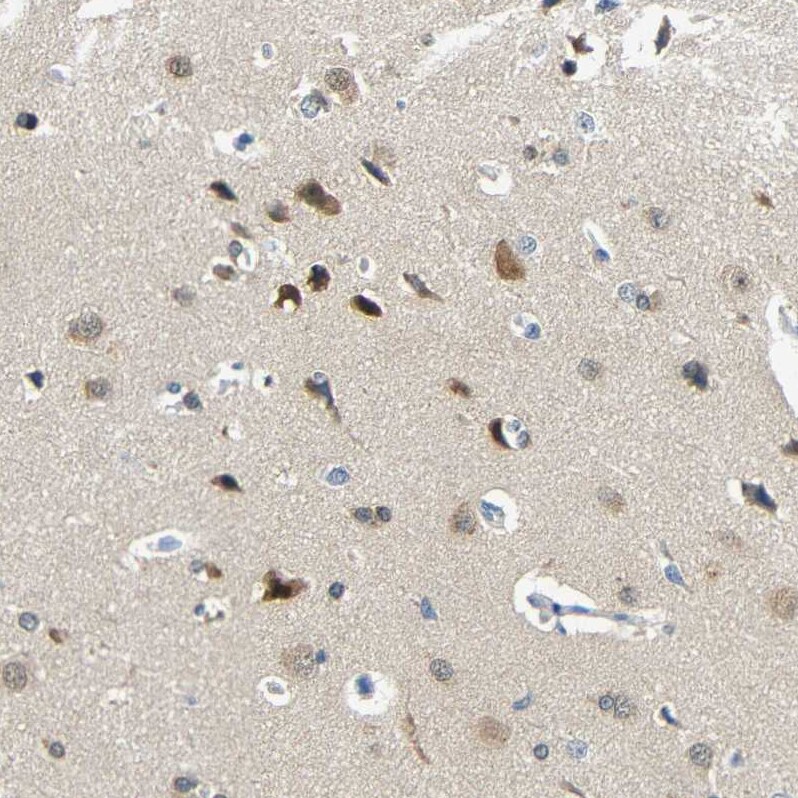 Centaurin alpha 1 Antibody - BSA Free Immunohistochemistry-Paraffin: Centaurin alpha 1 Antibody - BSA Free [NBP1-88098]