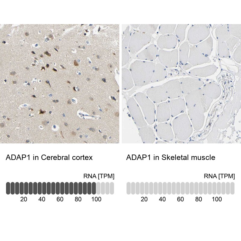 Centaurin alpha 1 Antibody - BSA Free Immunohistochemistry-Paraffin: Centaurin alpha 1 Antibody - BSA Free [NBP1-88098]