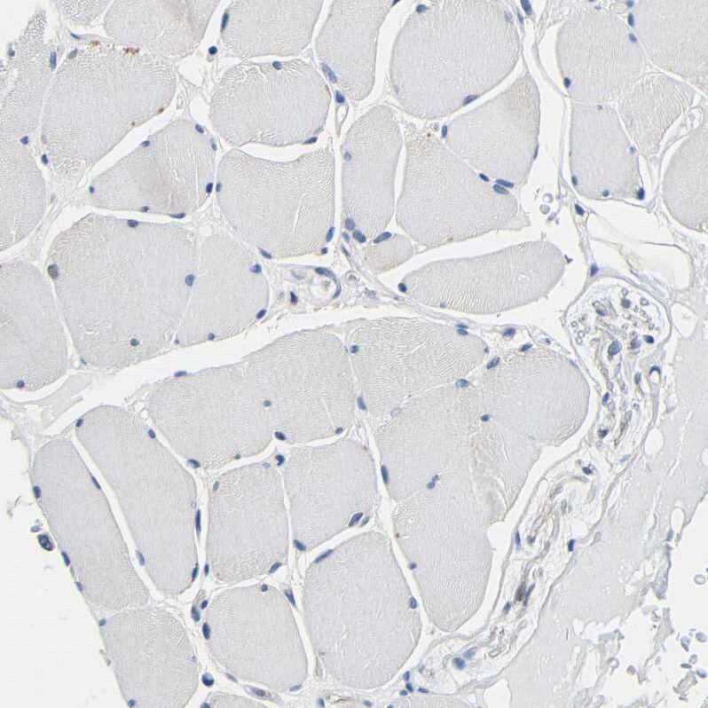 Centaurin alpha 1 Antibody - BSA Free Immunohistochemistry-Paraffin: Centaurin alpha 1 Antibody - BSA Free [NBP1-88098]