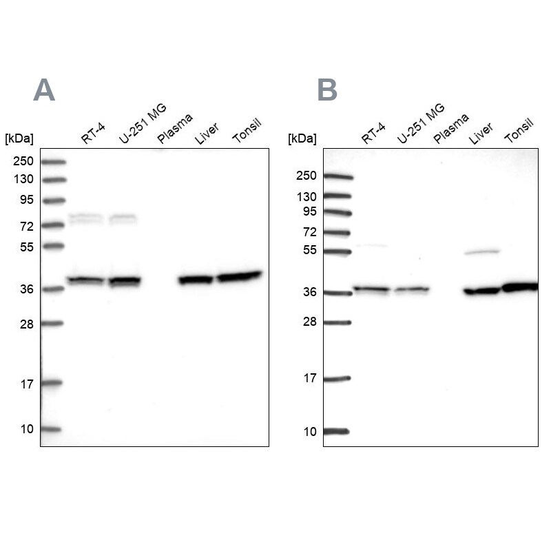 Transaldolase 1 Antibody - BSA Free Western Blot: Transaldolase 1 Antibody - BSA Free [NBP1-88109]