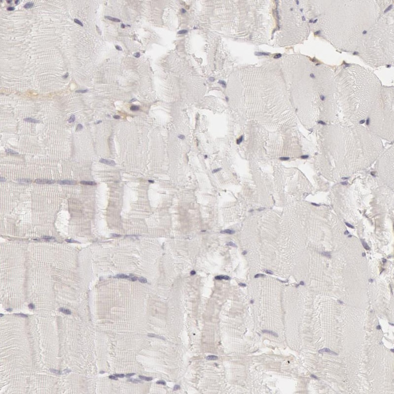 Complement C7 Antibody - BSA Free Immunohistochemistry-Paraffin: Complement C7 Antibody - BSA Free [NBP1-88119]