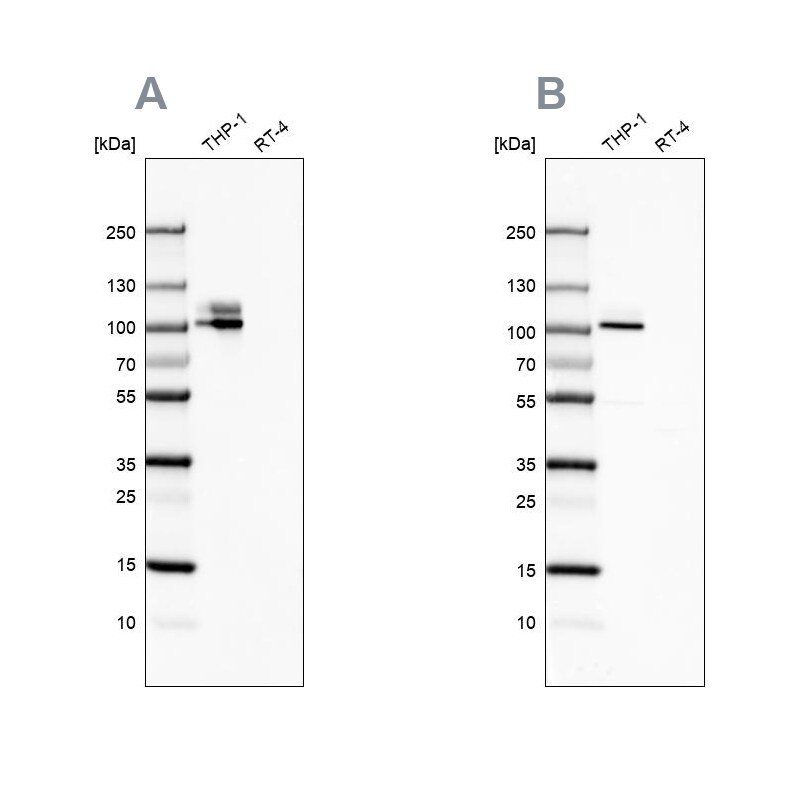 Integrin beta 2/CD18 Antibody - BSA Free Western Blot: Integrin beta 2/CD18 Antibody - BSA Free [NBP1-88128]