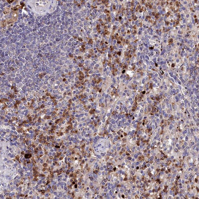 CD161 Antibody - BSA Free Immunohistochemistry: CD161 Antibody - BSA Free [NBP1-88130]