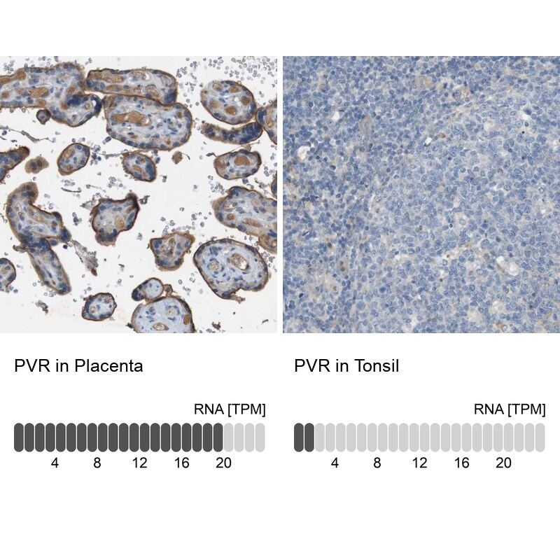 CD155/PVR Antibody - BSA Free Immunohistochemistry-Paraffin: CD155/PVR Antibody - BSA Free [NBP1-88131]