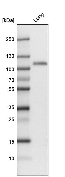 Thrombomodulin/BDCA-3 Antibody - BSA Free Western Blot: Thrombomodulin/BDCA-3 Antibody - BSA Free [NBP1-88133]