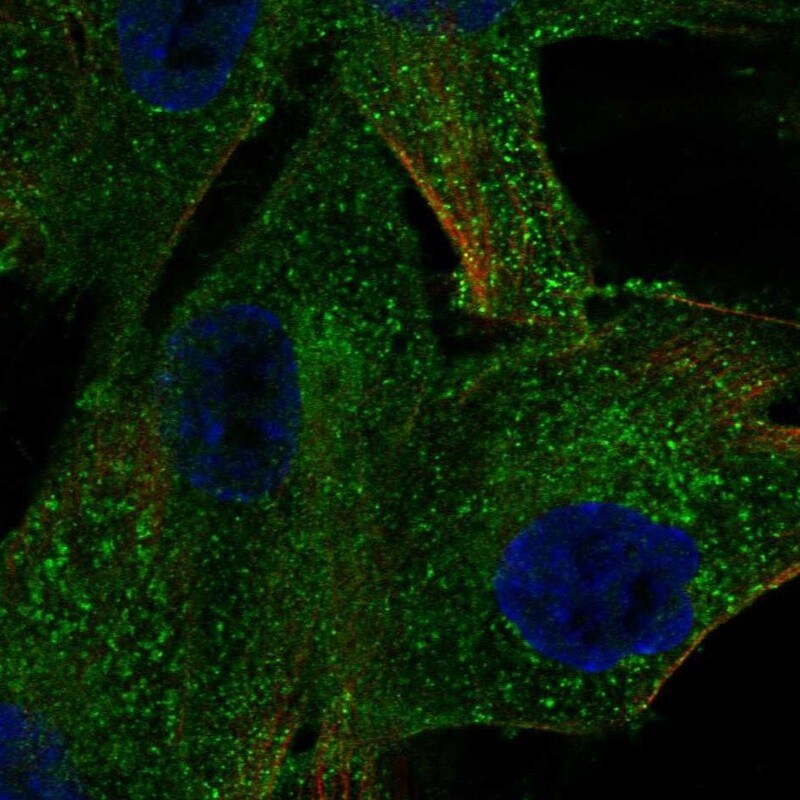 PDGF R beta Antibody - BSA Free Immunocytochemistry/ Immunofluorescence: PDGF R beta Antibody - BSA Free [NBP1-88134]