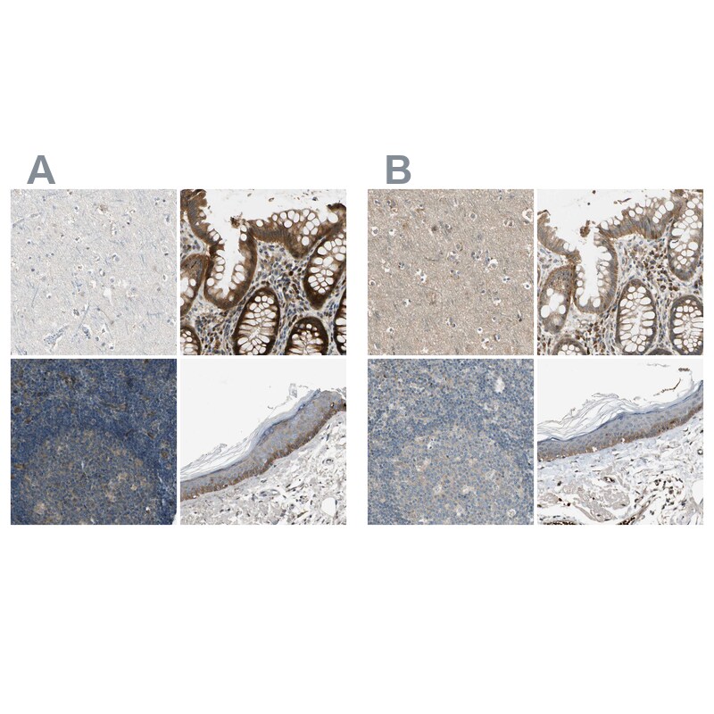 MSPR/Ron Antibody - BSA Free Immunohistochemistry-Paraffin: MSPR/Ron Antibody - BSA Free [NBP1-88136]