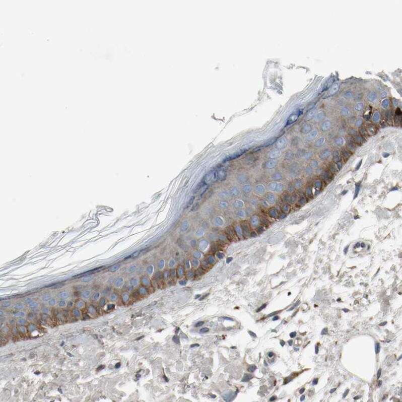 MSPR/Ron Antibody - BSA Free Immunohistochemistry-Paraffin: MSPR/Ron Antibody - BSA Free [NBP1-88136]