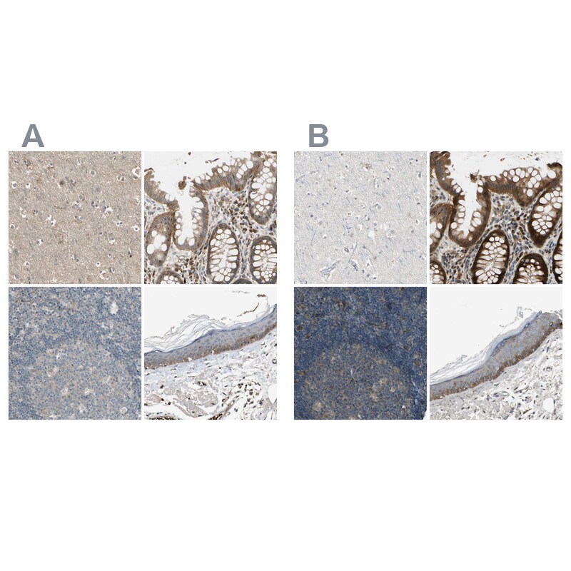 MSPR/Ron Antibody - BSA Free Immunohistochemistry-Paraffin: MSPR/Ron Antibody - BSA Free [NBP1-88137]