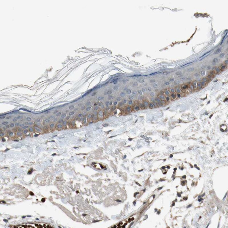 MSPR/Ron Antibody - BSA Free Immunohistochemistry-Paraffin: MSPR/Ron Antibody - BSA Free [NBP1-88137]