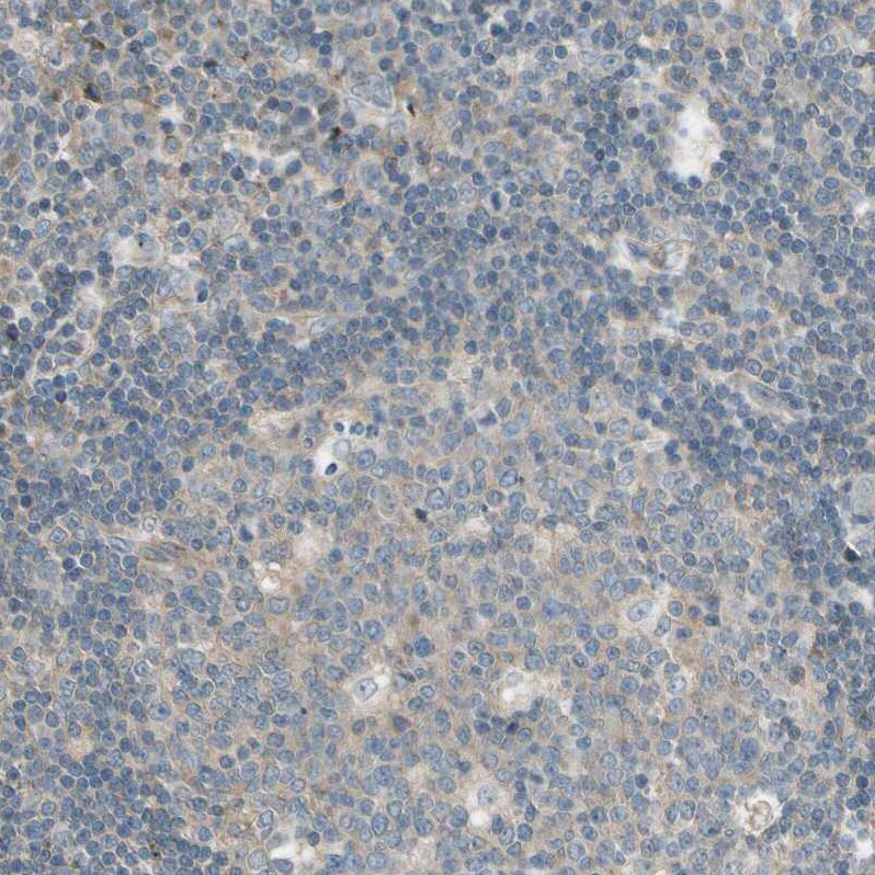 MSPR/Ron Antibody - BSA Free Immunohistochemistry-Paraffin: MSPR/Ron Antibody - BSA Free [NBP1-88137]