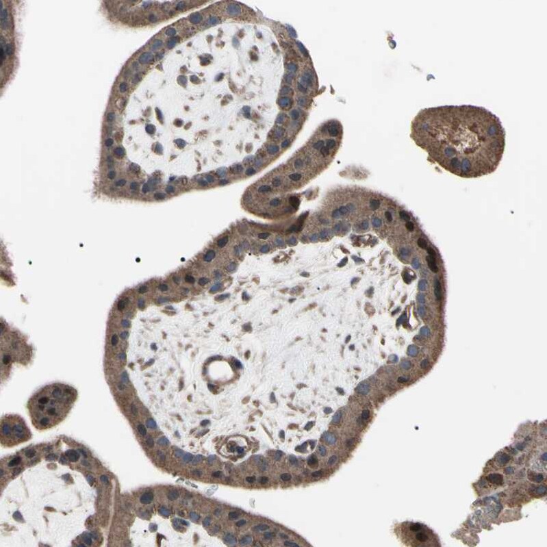 TNF RI/TNFRSF1A Antibody - BSA Free Immunohistochemistry-Paraffin: TNF RI/TNFRSF1A Antibody - BSA Free [NBP1-88140]