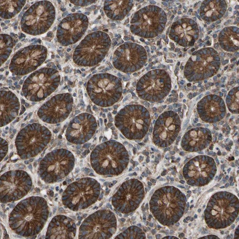 TNF RI/TNFRSF1A Antibody - BSA Free Immunohistochemistry-Paraffin: TNF RI/TNFRSF1A Antibody - BSA Free [NBP1-88140]