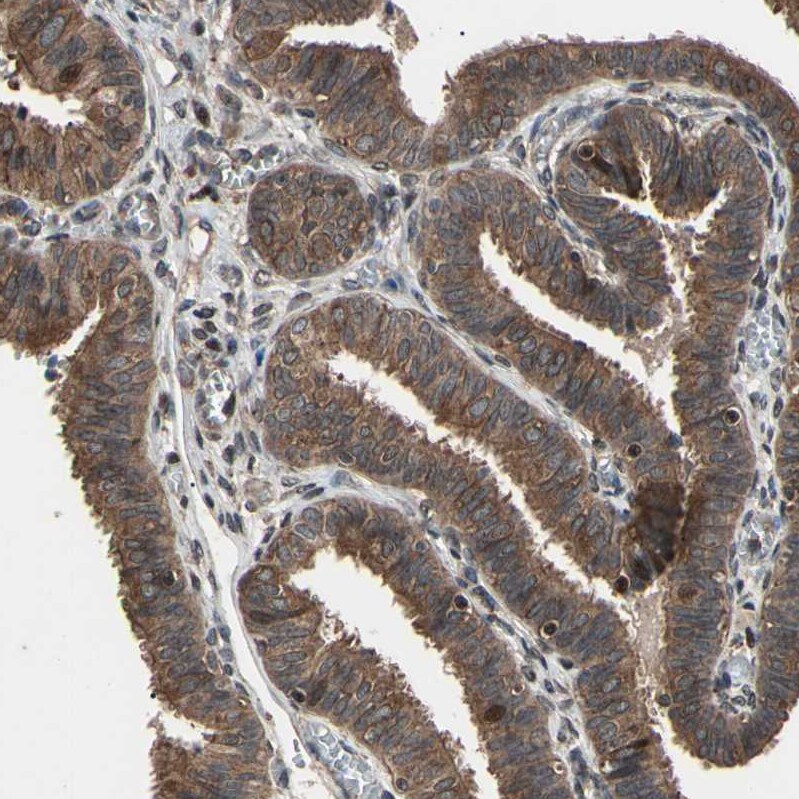 TNF RI/TNFRSF1A Antibody - BSA Free Immunohistochemistry-Paraffin: TNF RI/TNFRSF1A Antibody - BSA Free [NBP1-88140]