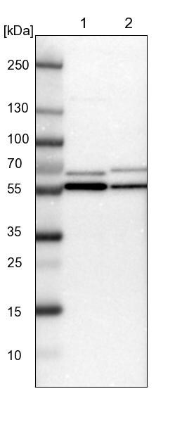 TCP1-beta Antibody - BSA Free Western Blot: TCP1-beta Antibody - BSA Free [NBP1-88147]