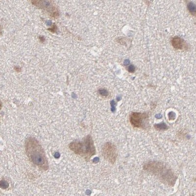 TCP1-beta Antibody - BSA Free Immunohistochemistry-Paraffin: TCP1-beta Antibody - BSA Free [NBP1-88147]