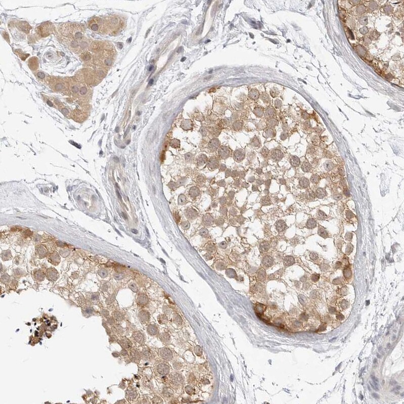 TCP1 alpha Antibody - BSA Free Immunohistochemistry-Paraffin: TCP1 alpha Antibody - BSA Free [NBP1-88148]