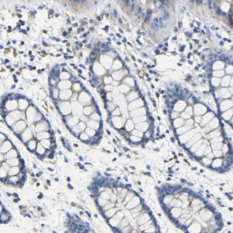 CC Chemokine Receptor D6 Antibody - BSA Free Immunohistochemistry-Paraffin: CC Chemokine Receptor D6 Antibody - BSA Free [NBP1-88150]