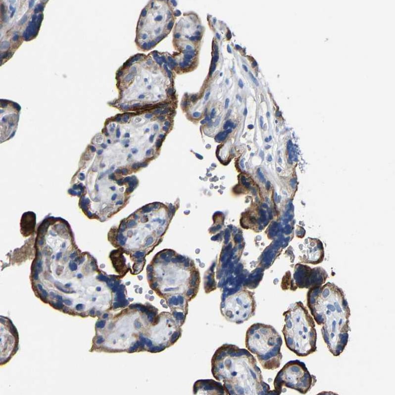 CC Chemokine Receptor D6 Antibody - BSA Free Immunohistochemistry-Paraffin: CC Chemokine Receptor D6 Antibody - BSA Free [NBP1-88150]