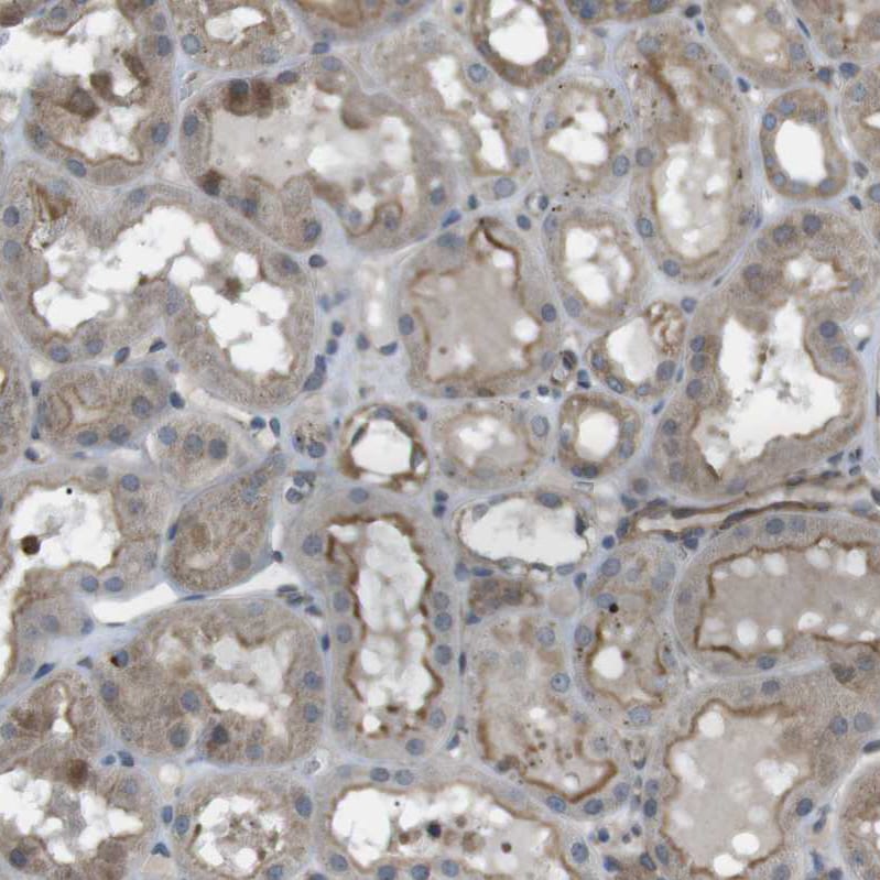 KANK2 Antibody - BSA Free Immunohistochemistry: KANK2 Antibody [NBP1-89080]
