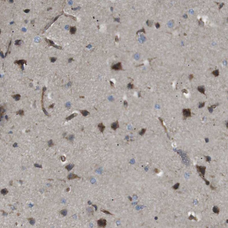 KANK2 Antibody - BSA Free Immunohistochemistry: KANK2 Antibody [NBP1-89080]