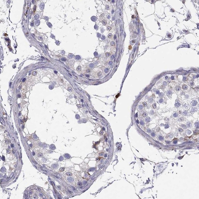 CNOX Antibody - BSA Free Immunohistochemistry-Paraffin: CNOX Antibody [NBP1-88152]