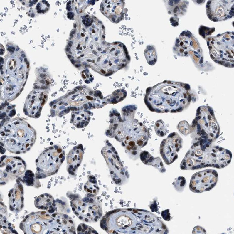 Cyclin E1 Antibody - BSA Free Immunohistochemistry-Paraffin: Cyclin E1 Antibody - BSA Free [NBP1-88153]