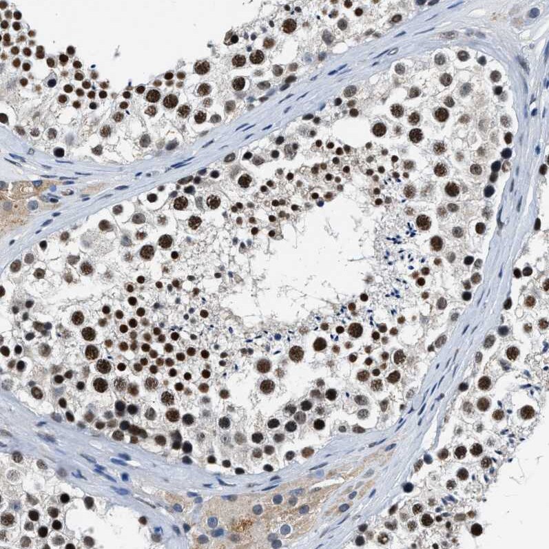 Cyclin E1 Antibody - BSA Free Immunohistochemistry-Paraffin: Cyclin E1 Antibody - BSA Free [NBP1-88153]