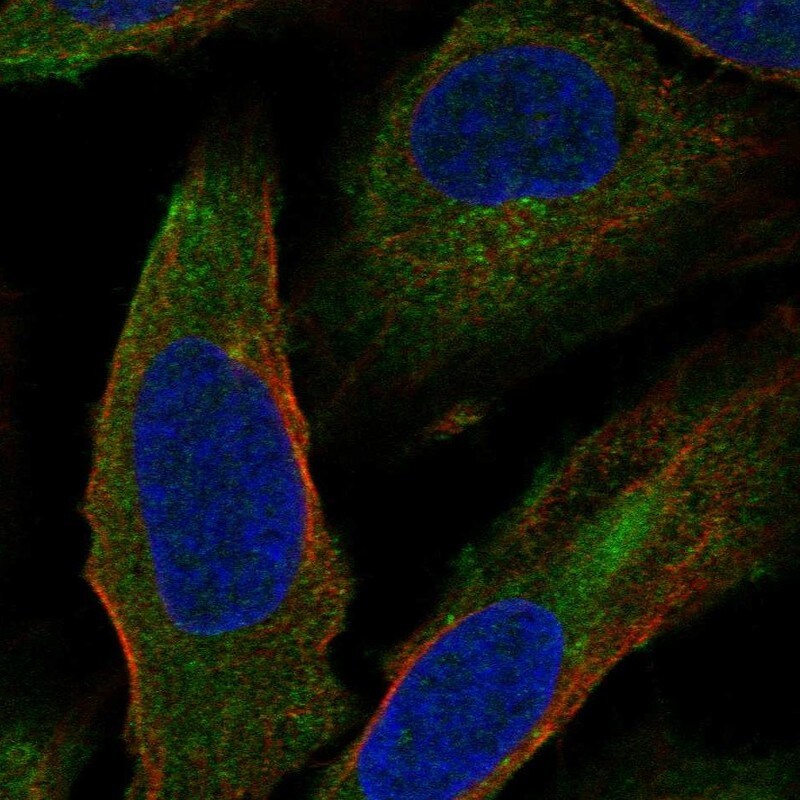 CCDC5 Antibody - BSA Free Immunocytochemistry/ Immunofluorescence: CCDC5 Antibody [NBP1-88159]