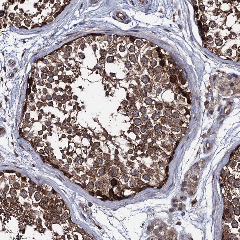 CCDC5 Antibody - BSA Free Immunohistochemistry-Paraffin: CCDC5 Antibody - BSA Free [NBP1-88159]