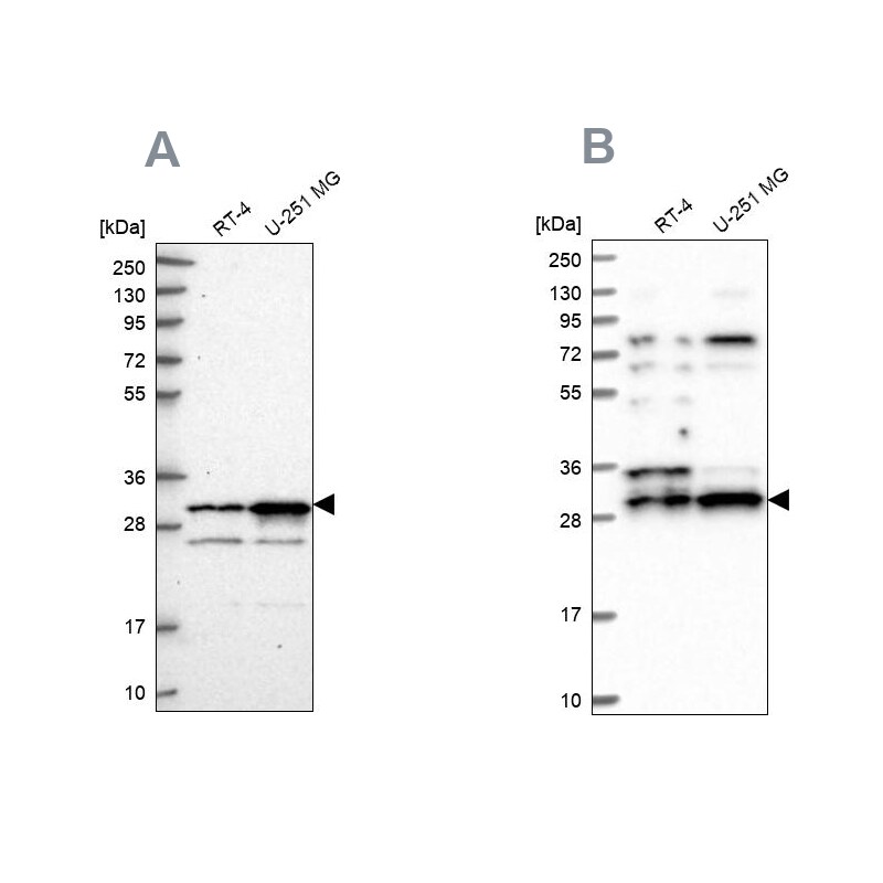 CCDC5 Antibody - BSA Free Western Blot: CCDC5 Antibody - BSA Free [NBP1-88159]