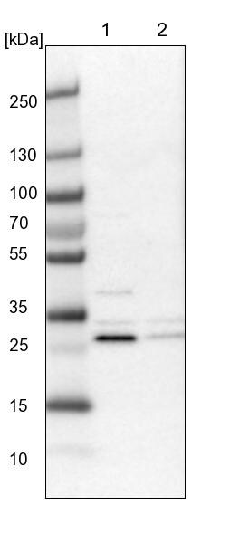 CCDC44 Antibody - BSA Free Western Blot: CCDC44 Antibody - BSA Free [NBP1-88160]