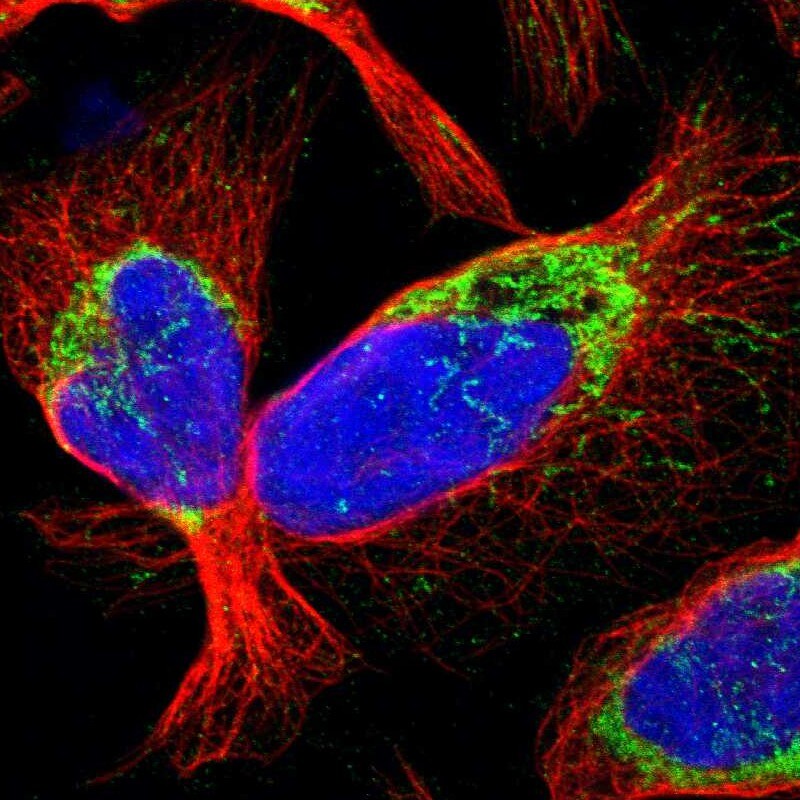 CCDC44 Antibody - BSA Free Immunocytochemistry/ Immunofluorescence: CCDC44 Antibody [NBP1-88162]