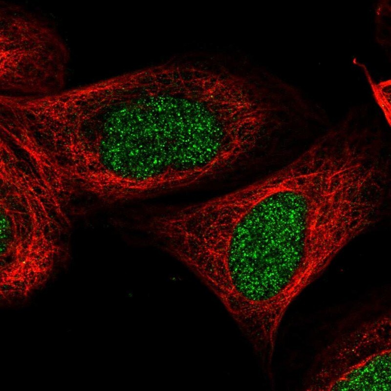 CCDC16 Antibody - BSA Free Immunocytochemistry/ Immunofluorescence: CCDC16 Antibody [NBP1-88164]