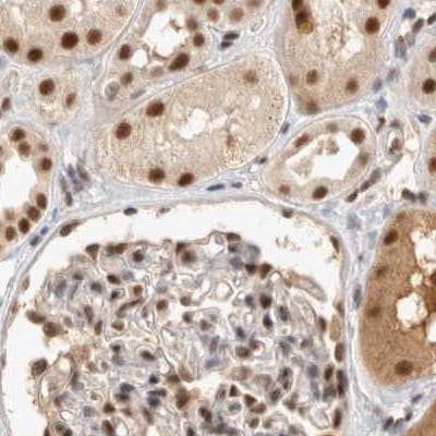 CCDC16 Antibody - BSA Free Immunohistochemistry-Paraffin: CCDC16 Antibody [NBP1-88165]
