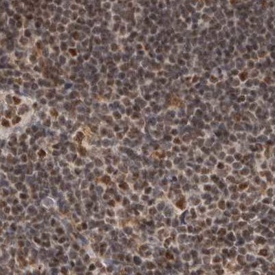 CCDC16 Antibody - BSA Free Immunohistochemistry-Paraffin: CCDC16 Antibody [NBP1-88165]