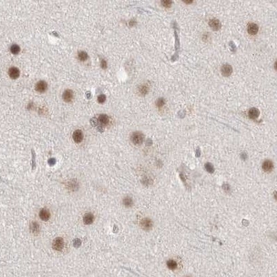 CCDC16 Antibody - BSA Free Immunohistochemistry-Paraffin: CCDC16 Antibody [NBP1-88165]