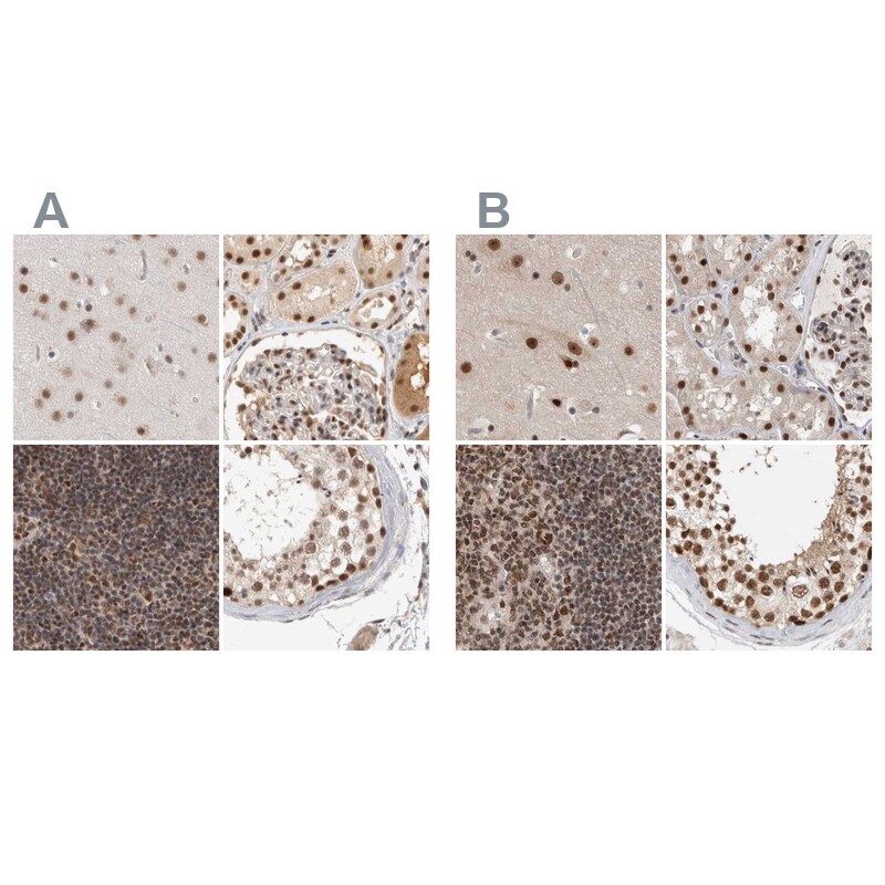 CCDC16 Antibody - BSA Free Immunohistochemistry-Paraffin: CCDC16 Antibody [NBP1-88165]