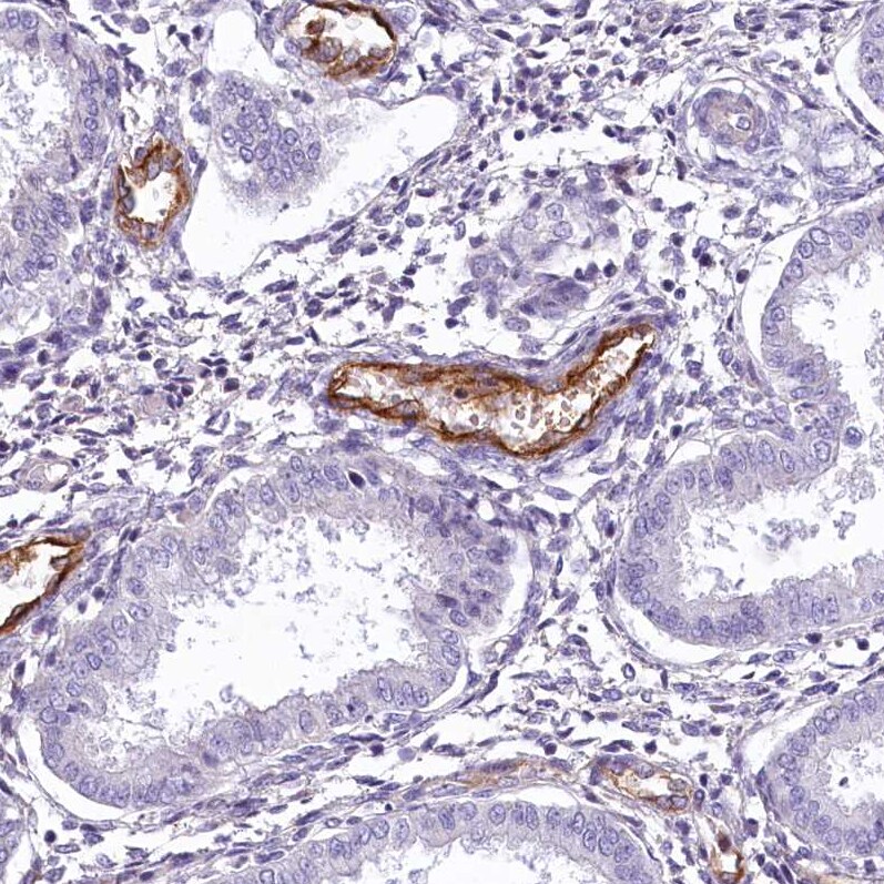EPCR Antibody - BSA Free Immunohistochemistry: EPCR Antibody - BSA Free [NBP1-88168]