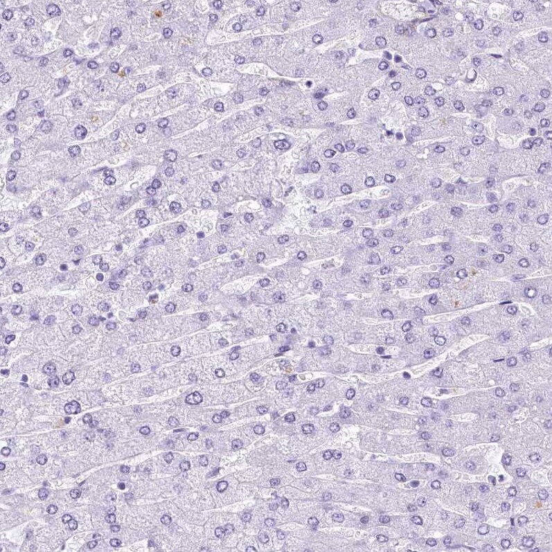 EPCR Antibody - BSA Free Immunohistochemistry: EPCR Antibody - BSA Free [NBP1-88168]