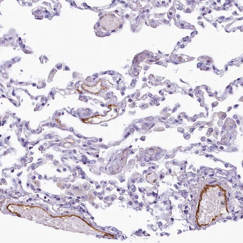 EPCR Antibody - BSA Free Immunohistochemistry: EPCR Antibody - BSA Free [NBP1-88168]