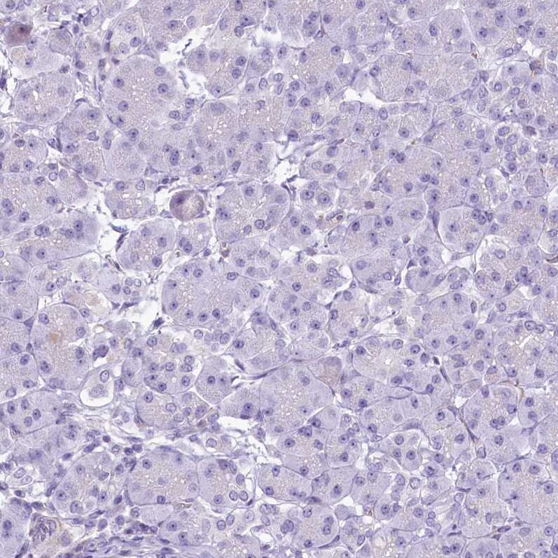 EPCR Antibody - BSA Free Immunohistochemistry: EPCR Antibody - BSA Free [NBP1-88168]