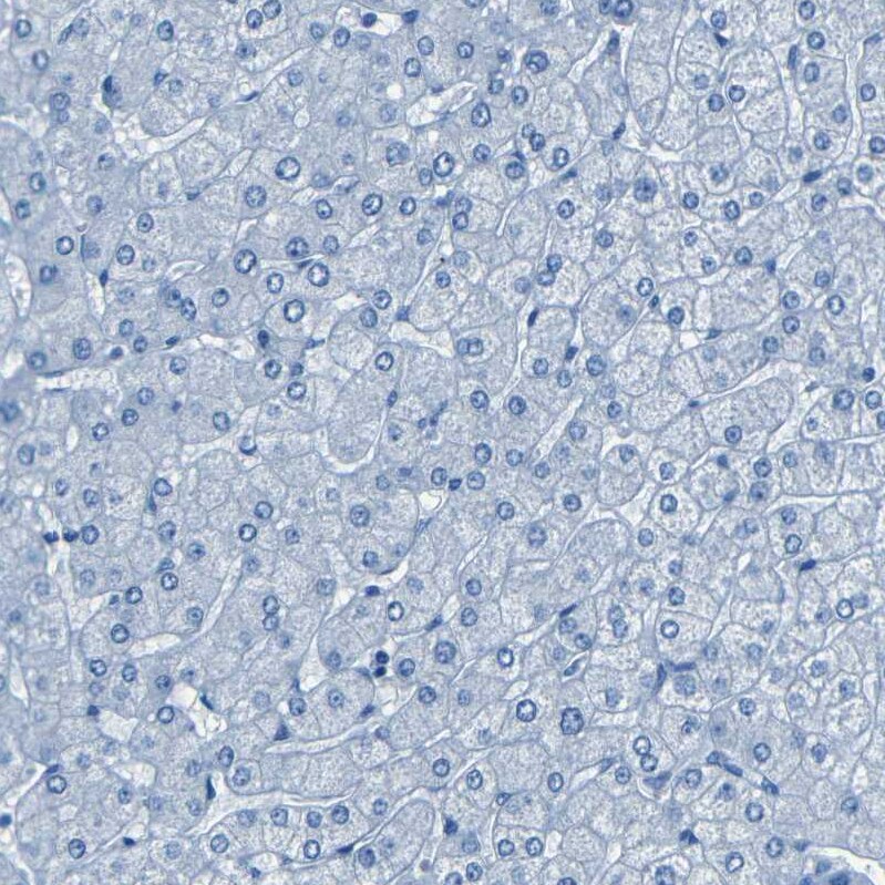 Fibrillin 2 Antibody - BSA Free Immunohistochemistry-Paraffin: Fibrillin 2 Antibody - BSA Free [NBP1-88169]